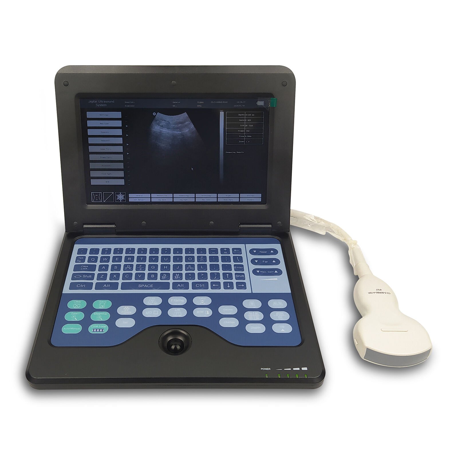 Laptop Tipi Taşınabilir Ultrason Cihazı (Kedi, Köpek, Koyun, Keçi İçin)