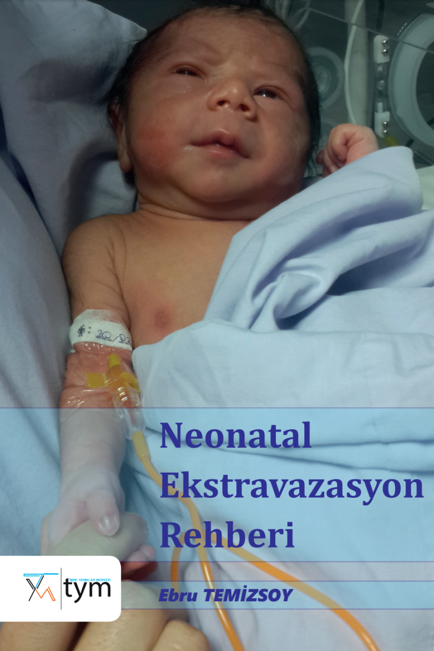 Neonatal Ekstravazasyon Rehberi