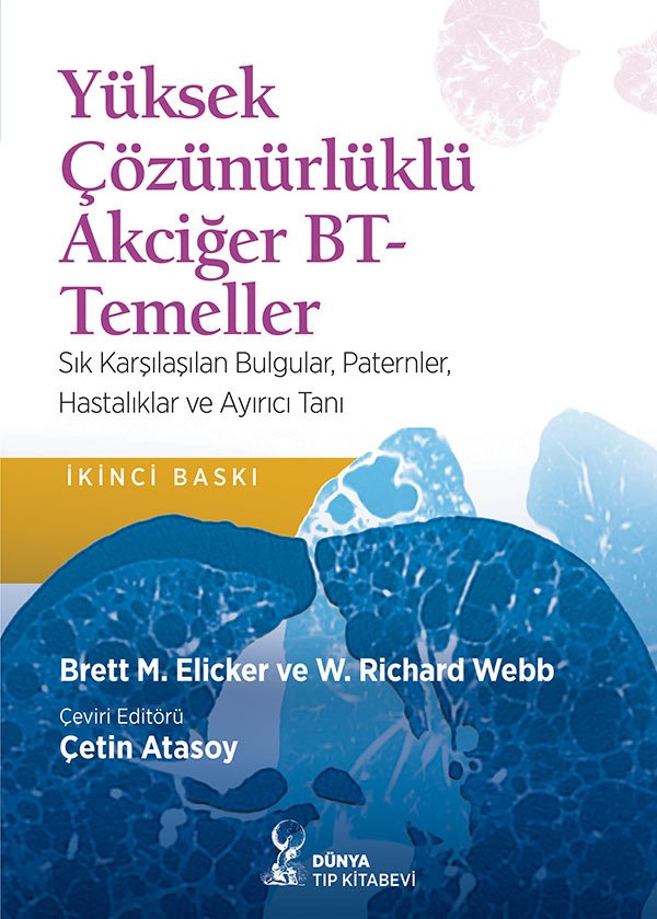 Yüksek Çözünürlüklü Akciğer BT-Temeller: Sık Karşılaşılan Bulgular, Paternler, Hastalıklar ve Ayrıcı Tanı(2. Baskı)