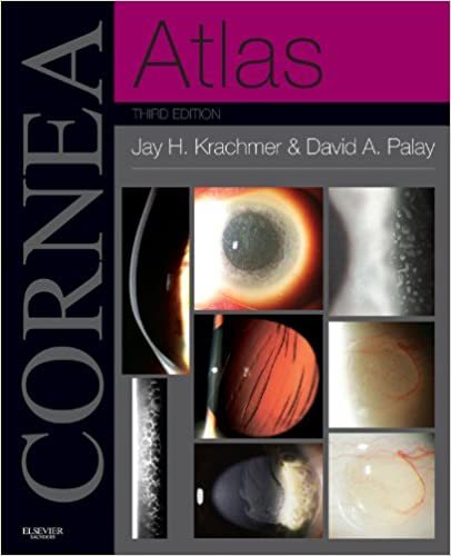 Cornea Atlas E-Book: Expert Consult-Online and Print 3rd. ed.
