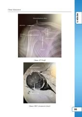 Fiziksel Tıp ve Rehabilitasyon Staj Destek Kitabı Olgular Eşliğinde Kas-İskelet Sistemi Muayenesi
