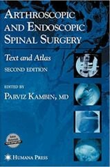Arthroscopıc and Endoscopıc Spınal Surgery