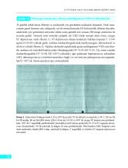 Elektrokardiyografi, Telekardiyografi ve Fizik Muayene ile Doğumsal Kalp Hastalıklarının Klinik Tanısı
