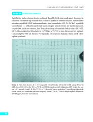 Elektrokardiyografi, Telekardiyografi ve Fizik Muayene ile Doğumsal Kalp Hastalıklarının Klinik Tanısı