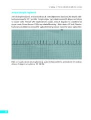 Normal ve Patolojik Pediatrik EKG Atlası