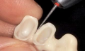 KLNK/ SET Zirkon Abutment hazırlama ve kesme, Z-Cut Diamond Instruments Zirconia