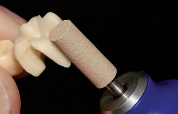 LBR/ ALLCERAMIC HYBRID HP