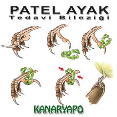 Kanaryapo Patel Ayak Tedavi Bileziği Seti 8 Adet