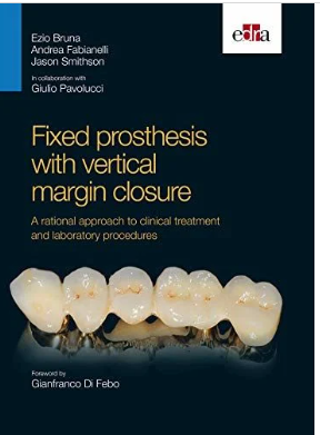 Fixed Prosthesis With Vertical Margin Closure