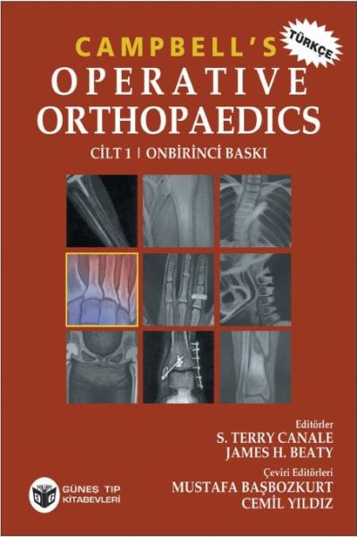Campbell's Operative Orthopaedics 4 Cilt, Türkçesi