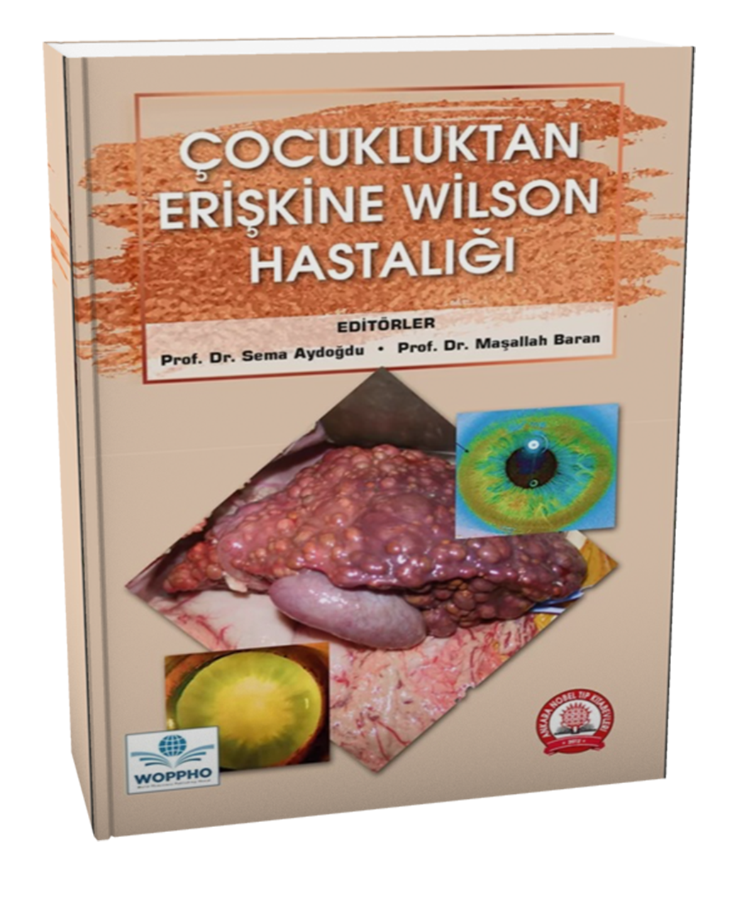 Çocukluktan Erişkine Wilson Hastalığı