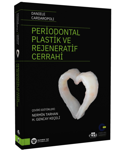 Periodontal Plastik ve Rejeneratif Cerrahi