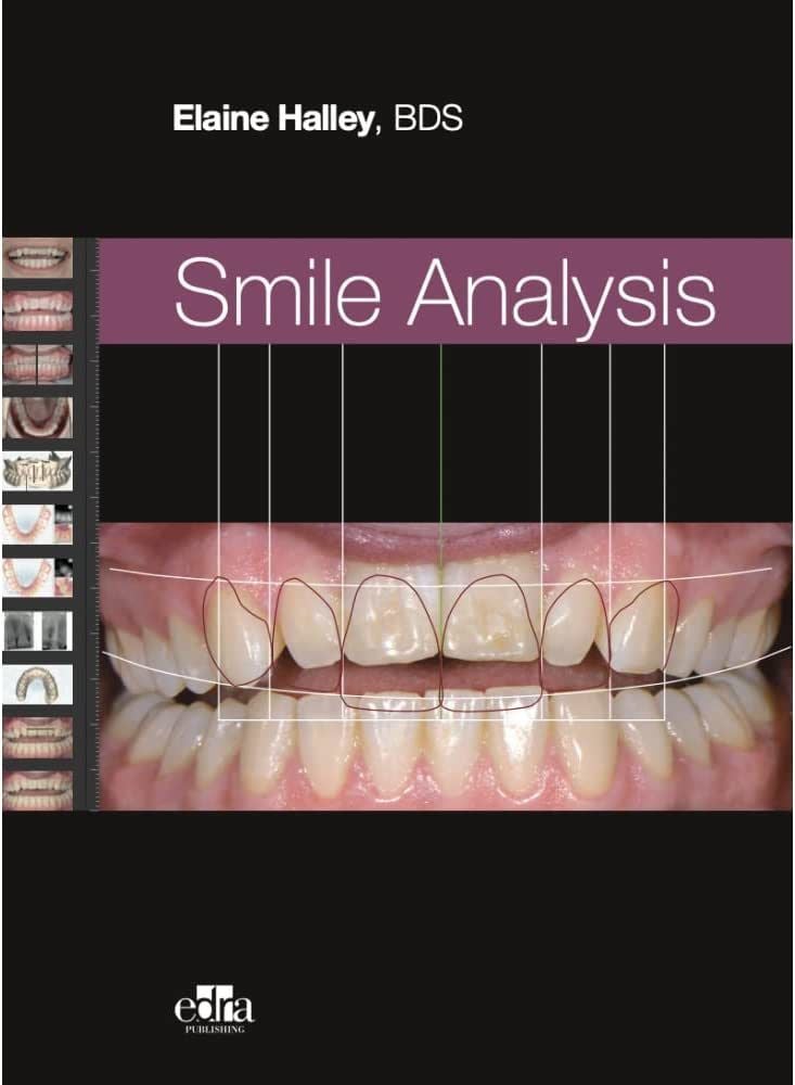 Smile Analysis - Hardcover Cover