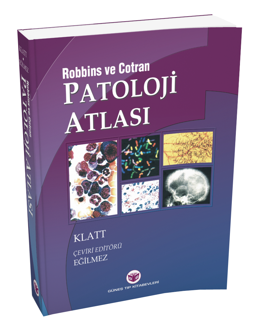 Robbins Patoloji Atlası