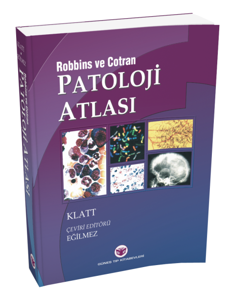 Robbins Patoloji Atlası