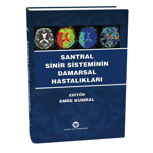 Santral Sinir Sisteminin Damarsal Hastalıkları