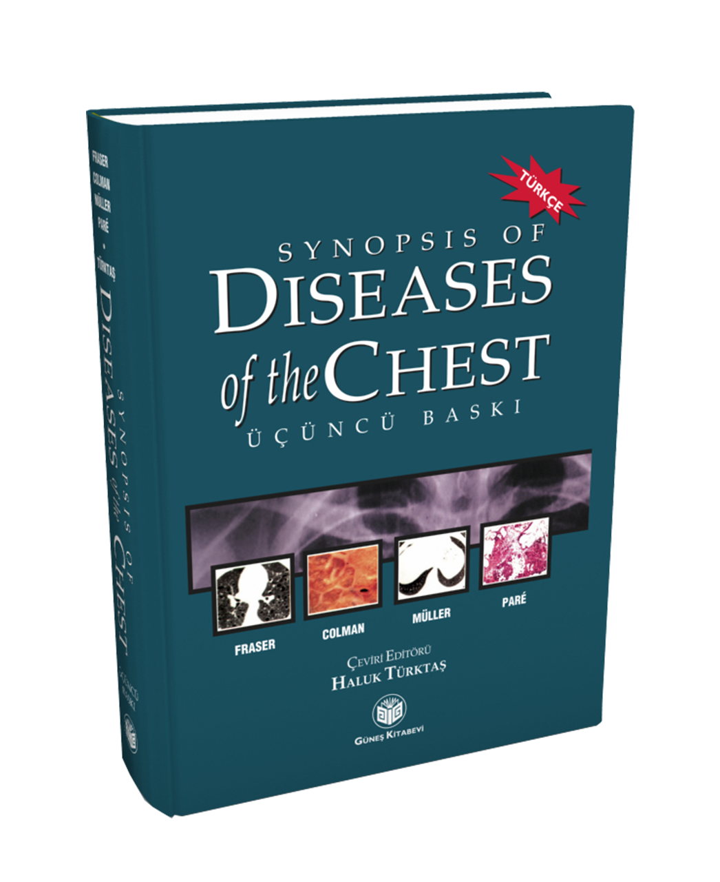 Synopsis of Diseases of The Chest (Türkçesi)