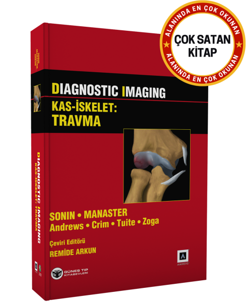 Diagnostic Imaging - Kas İskelet: Travma
