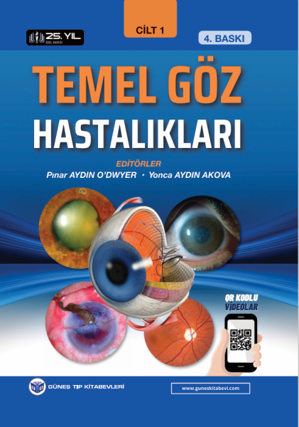 Temel Göz Hastalıkları 2 Cilt 4. Baskı