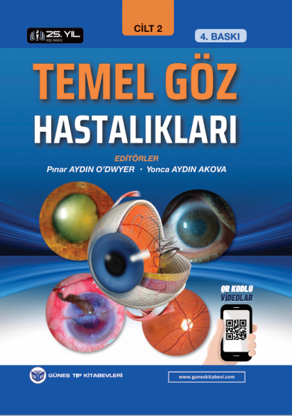 Temel Göz Hastalıkları 2 Cilt 4. Baskı