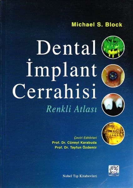 Dental İmplant Cerrahisi Renkli Atlası