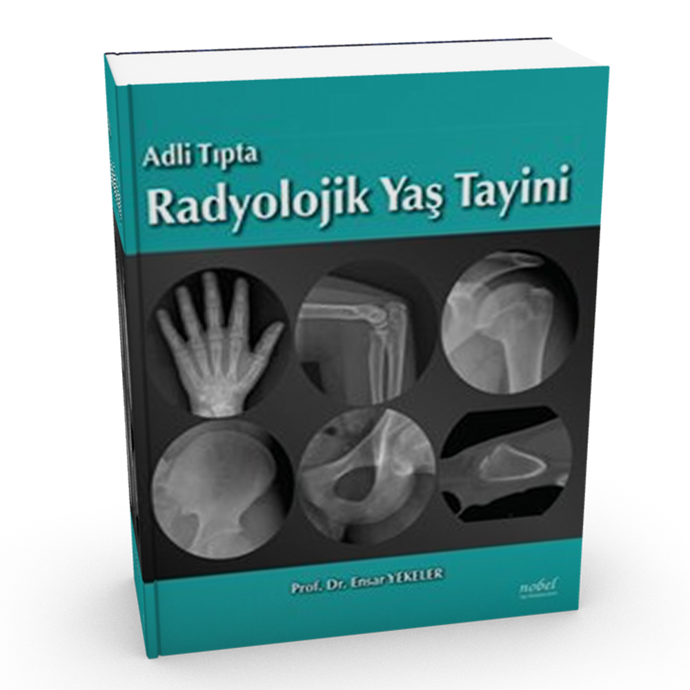 Adli Tıpta Radyolojik Yaş Tayini