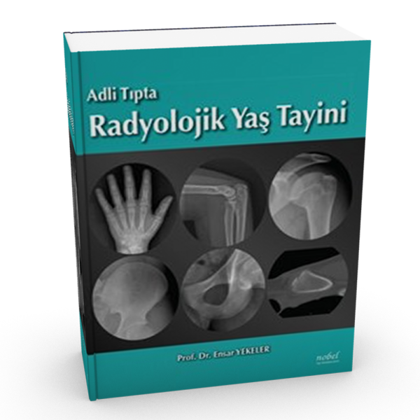 Adli Tıpta Radyolojik Yaş Tayini