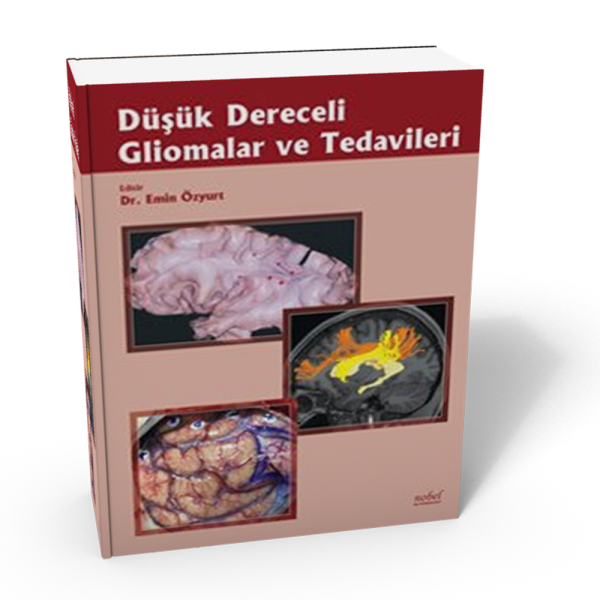 Düşük Dereceli Gliomalar ve Tedavileri