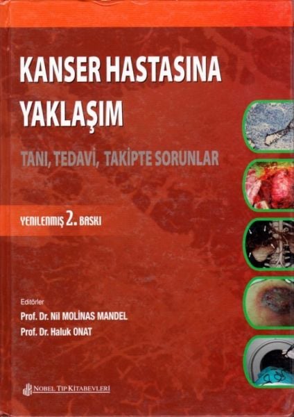 Kanser Hastasına Yaklaşım Tanı, Tedavi, Takipte Sorular