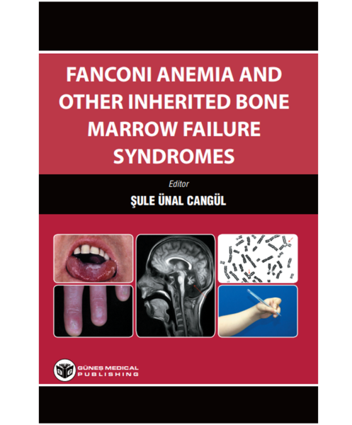 Fanconi Anemia And Other Inherited Bone Marrow Failure Syndromes