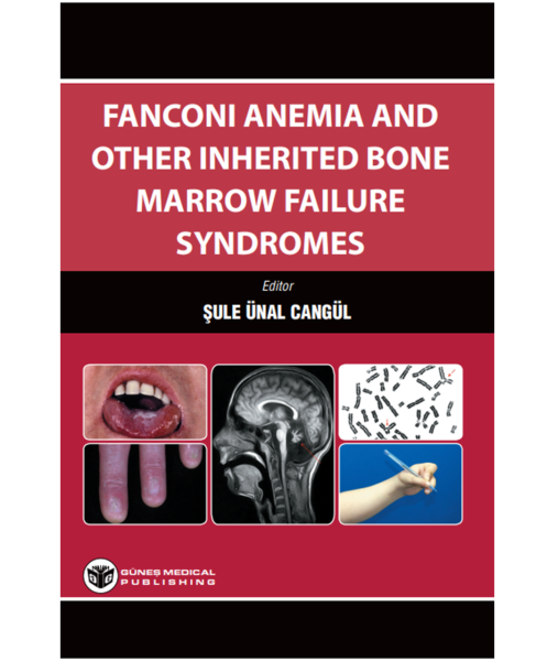 Fanconi Anemia And Other Inherited Bone Marrow Failure Syndromes