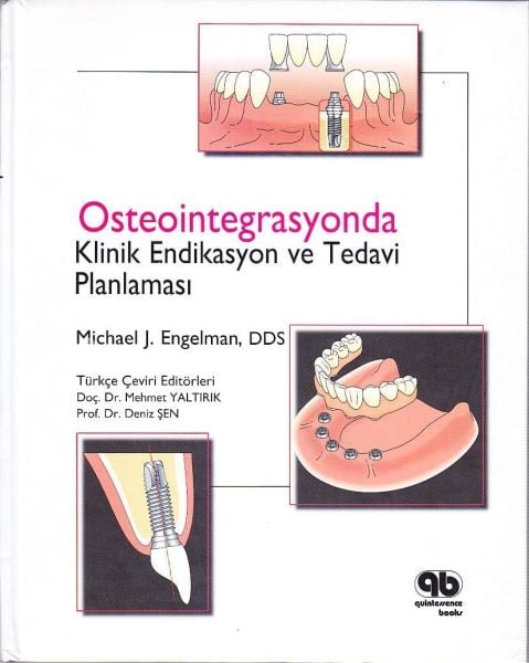 Osteointegrasyonda Klinik Endikasyon ve Planlama