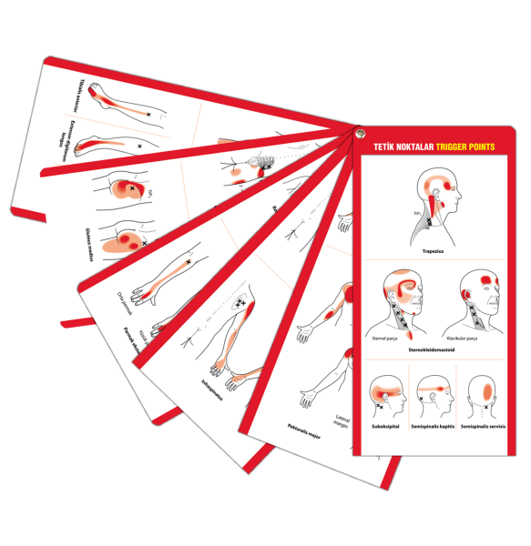 Tetik Noktalar Trigger Points