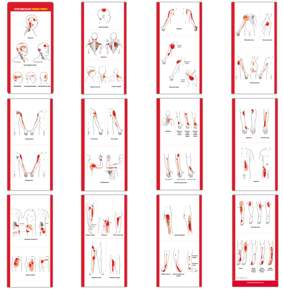 Tetik Noktalar Trigger Points