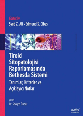 Tiroid Sitopatolojisi Raporlamasında Bethesda Sistemi: Tanımlar, Kriterler ve Açıklayıcı Notlar