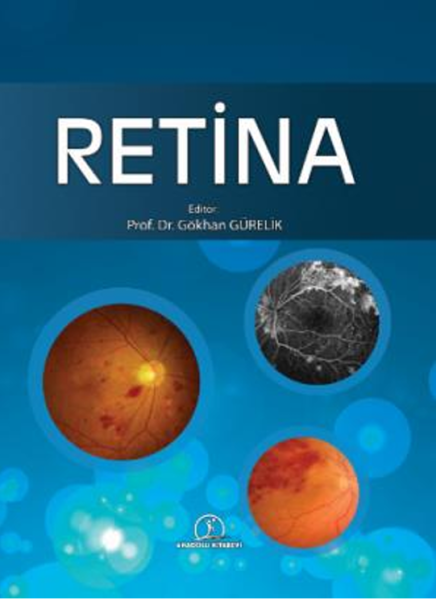 Retina ”Temel Retina  Hastalıklarına Güncel  Yaklaşımlar”