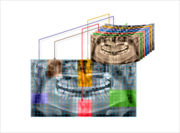 Vatech PAX-İ3D Green Volumetrik Tomografi, Dijital Panoramik ve Sefalometrik Görüntüleme Cihazı