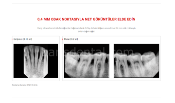 Ez Ray Air Periapikal Röntgen Cihazı