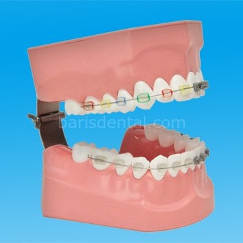 Ortodonti Fırçalama Modeli