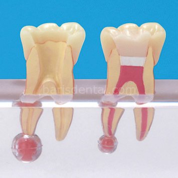 Hasta Eğitim Modeli / 4 Aşamalı Molar