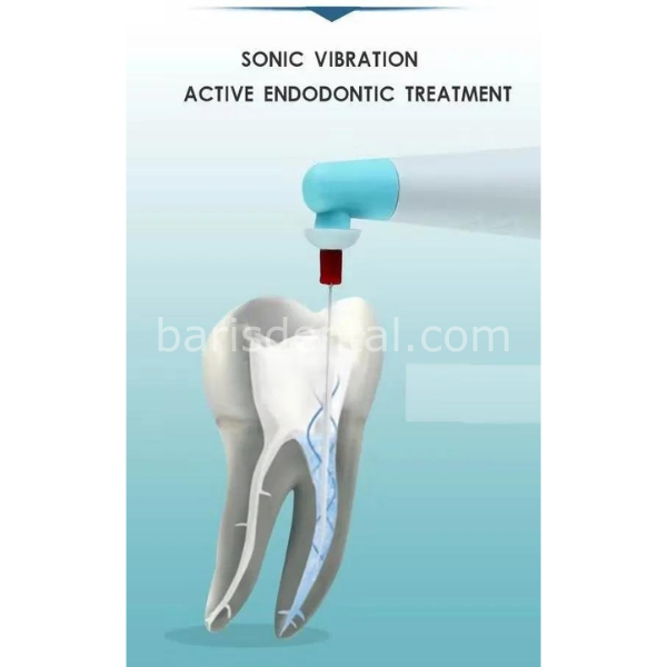 G-FORCE Sonic Endo Aktivatör (Yedek Uçlar Dahil)