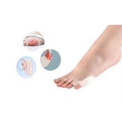 BUFFER® Makaralı Ayak Bunyon Koruyucu Serçe Parmak Düzeltici 2li
