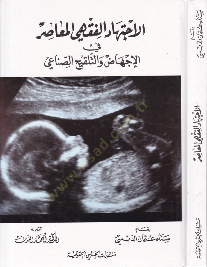 El-İçtihadul-Fıkhiyyul-Muasır vel-İçhaz vet-Telkihis-Sınai - الإجتهاد الفقهي المعاصر في الإجهاض والتلقيح الصناعي