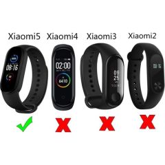 Case 4U Xiaomi Mi Band 6 / Mi Band 5 Akıllı Bileklik Kordonu Silikon Mavi