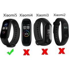 Case 4U Xiaomi Mi Band 6 / Mi Band 5 Akıllı Bileklik Kordonu Silikon Yeşil