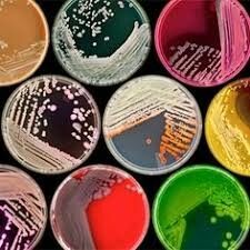 Petri Kabı Rehberi: Cam, Plastik, Paslanmaz Çelik ve PTFE Kaplarıyla Tanışın