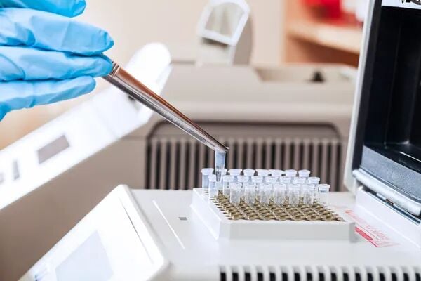 Laboratory Tweezers: The Key to Precision and Safety