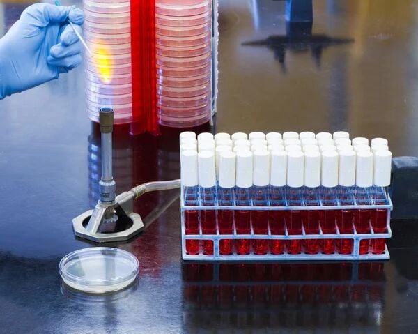 Reliable Heat Source for Laboratory Work: Bunsen Burners and Their Types