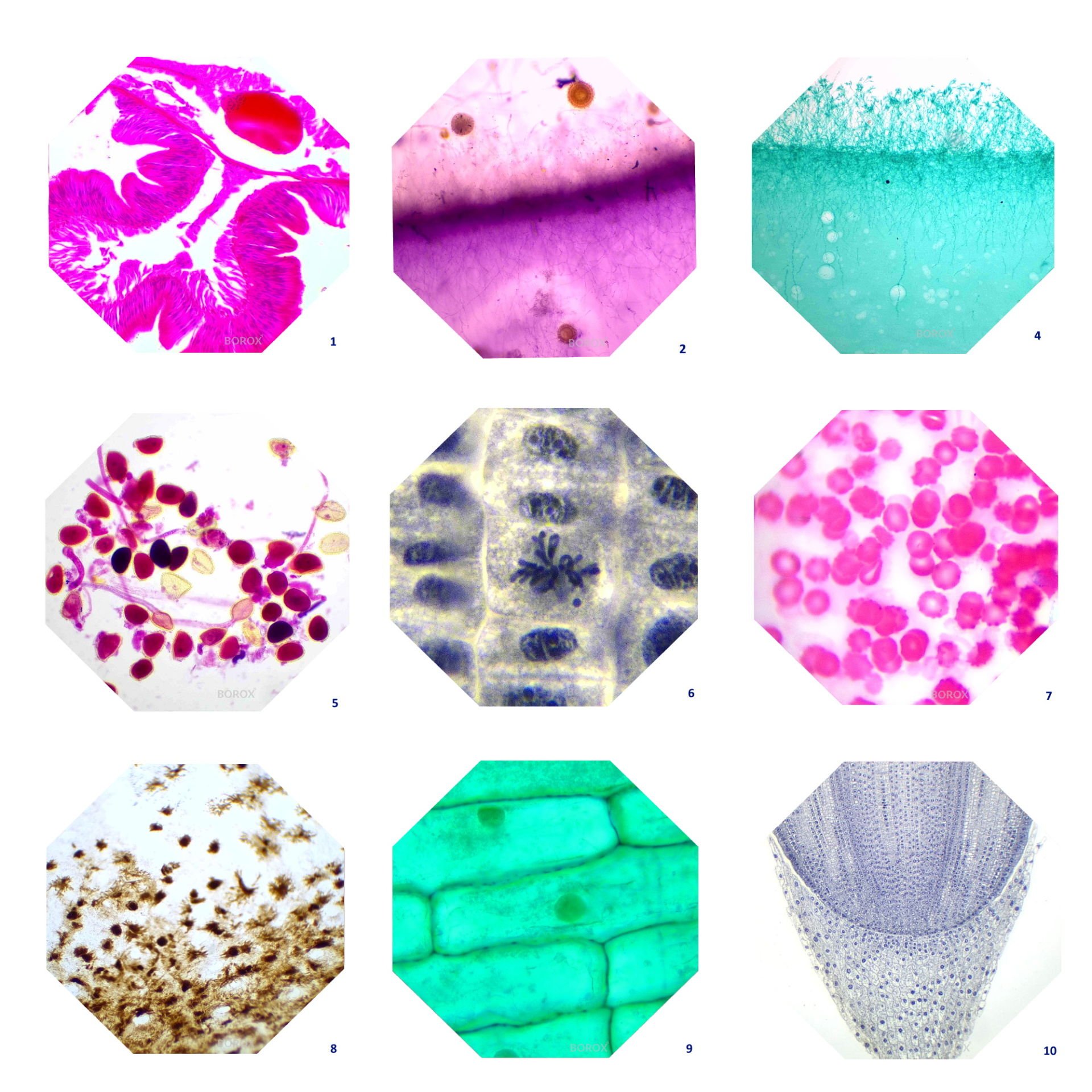 Mikroskop Slayt Seti - 10 Slayt - Bitkiler ve Böcekler