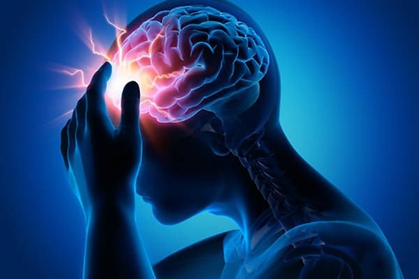 Migren Çeşitleri Nelerdir ?